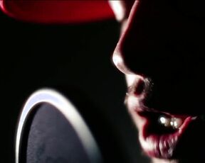 ST - 20 Bars